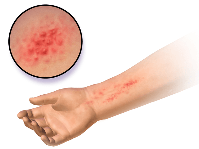 skin allergies