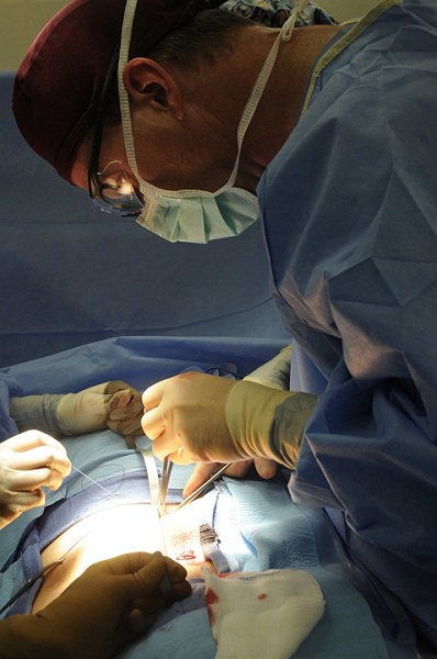 Breast Reduction Before and After: 3 Alternatives to Surgery