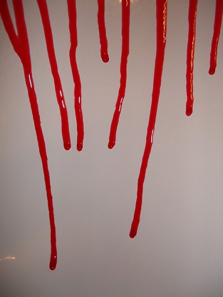excessive bleeding