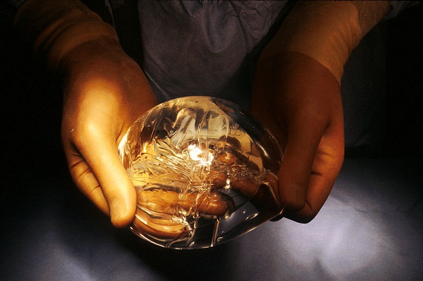 silicone gel-filled breast implants